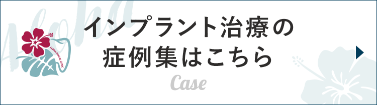 インプラント治療の症例集はこちら