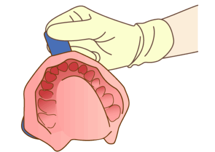 STEP4 型どり